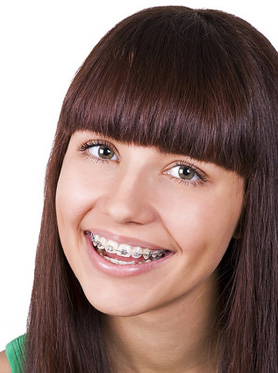 Orthodontic Retention - Altschul Orthodontics | Crawfordsville ...